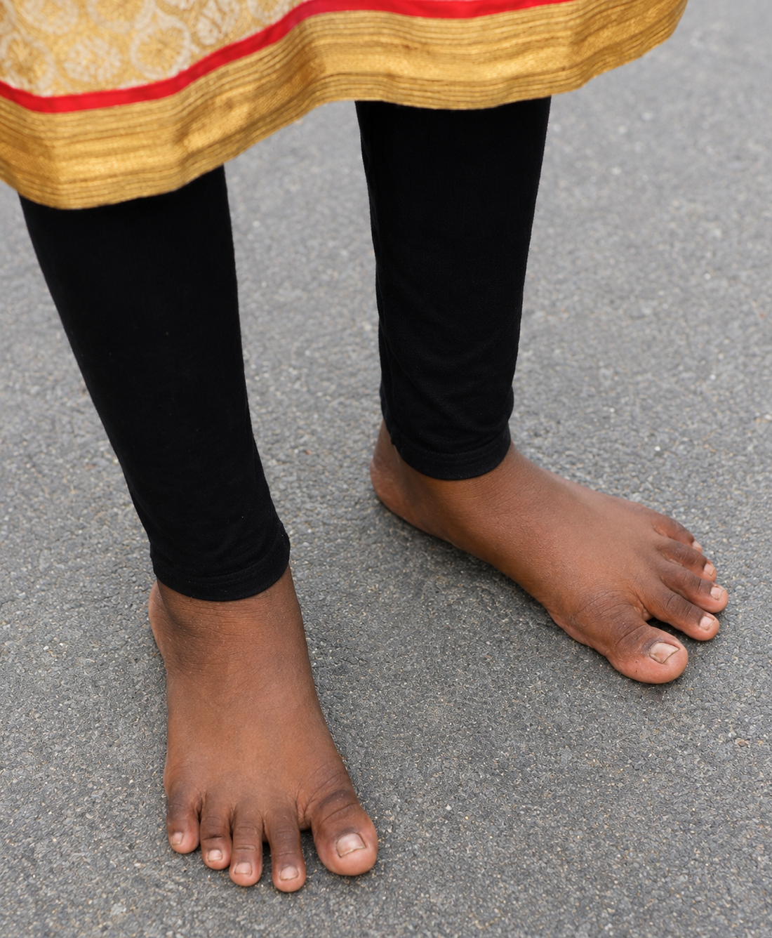 Modern Life Changed How Our Feet Function